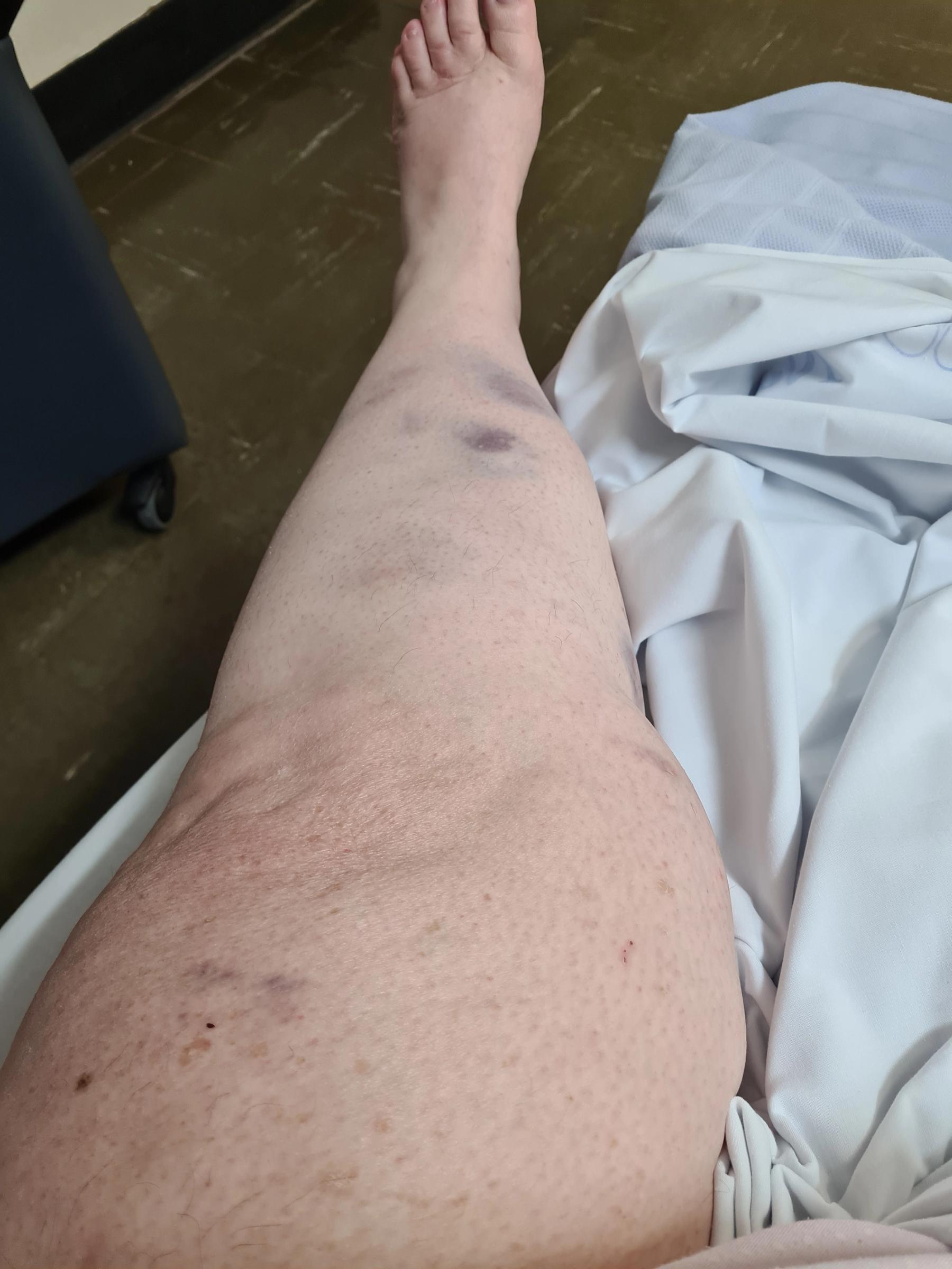 7..Hospital funny 